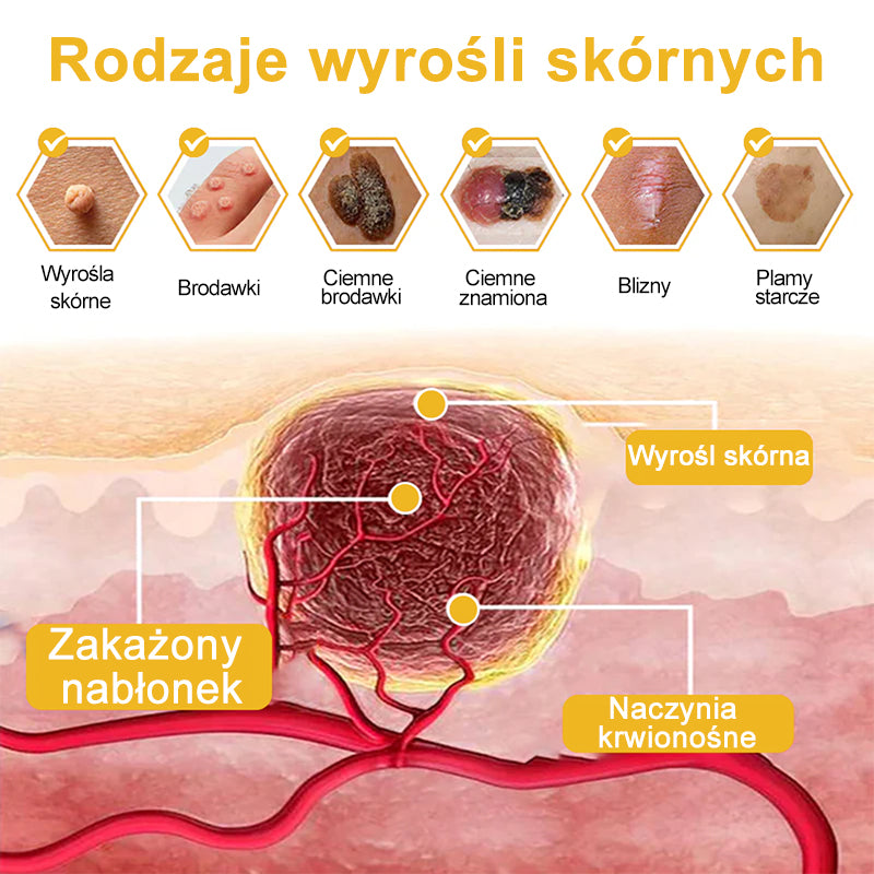 🌿Turonu™ Jad pszczeli Leczenie Krem (🔥Ostatni dzień promocji 80% taniej)